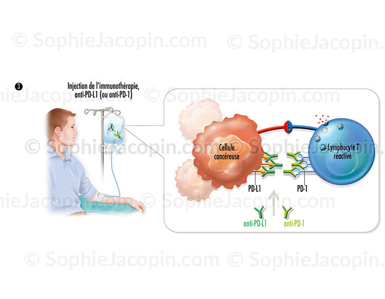 IMMUNOTHÉRAPIE – Image 3