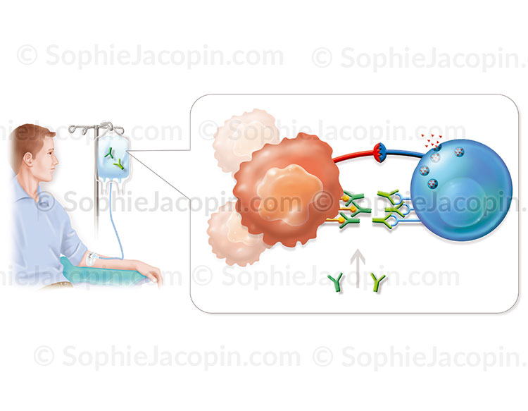 INJECTION D’IMMUNOMODULATEURS