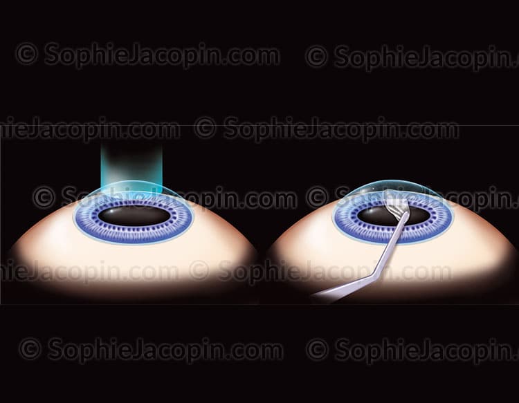 SMILE – Image 2